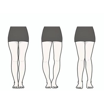 X脚・O脚・XO脚って？